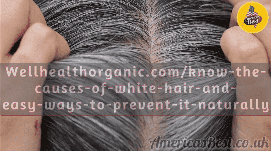 Wellhealthorganic.com/know-the-causes-of-white-hair-and-easy-ways-to-prevent-it-naturally